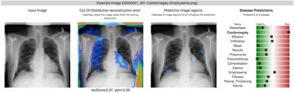 X-Ray Image2